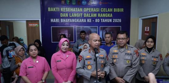 Sambut HUT Bhayangkara ke-80, Polda Banten Wujudkan Harapan 25 Anak Melalui Operasi Bibir Sumbing